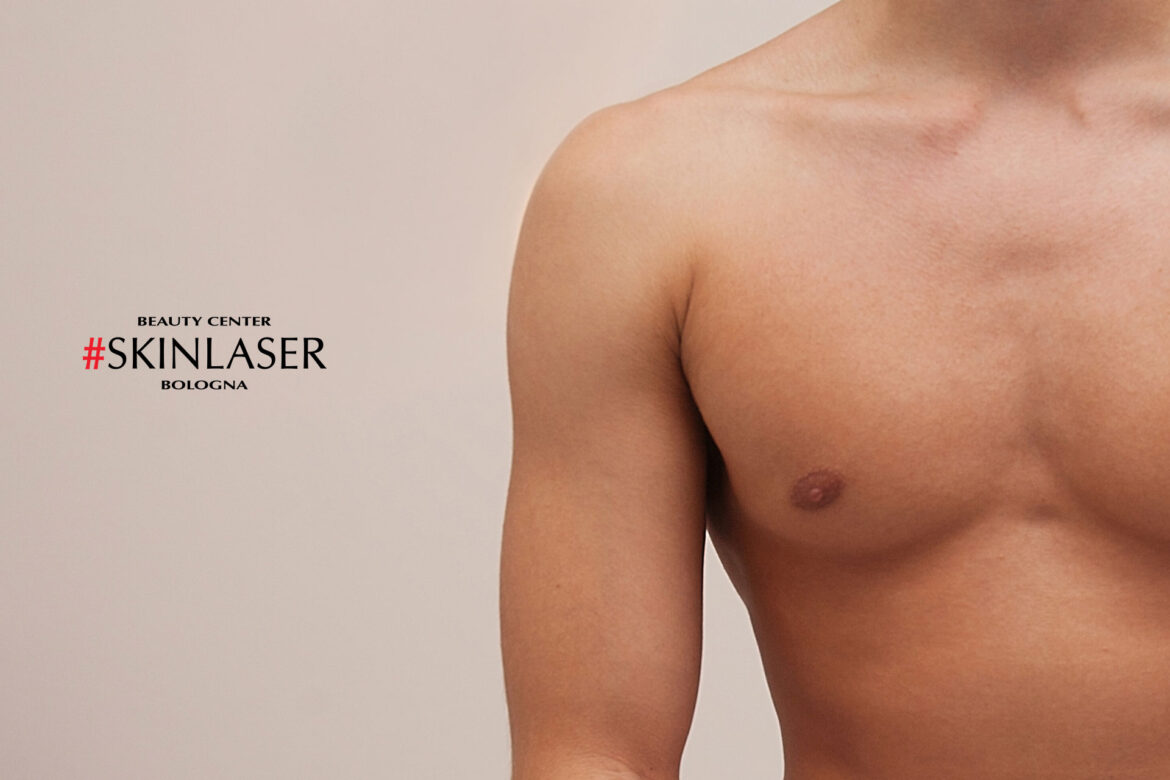 epilazione laser uomo